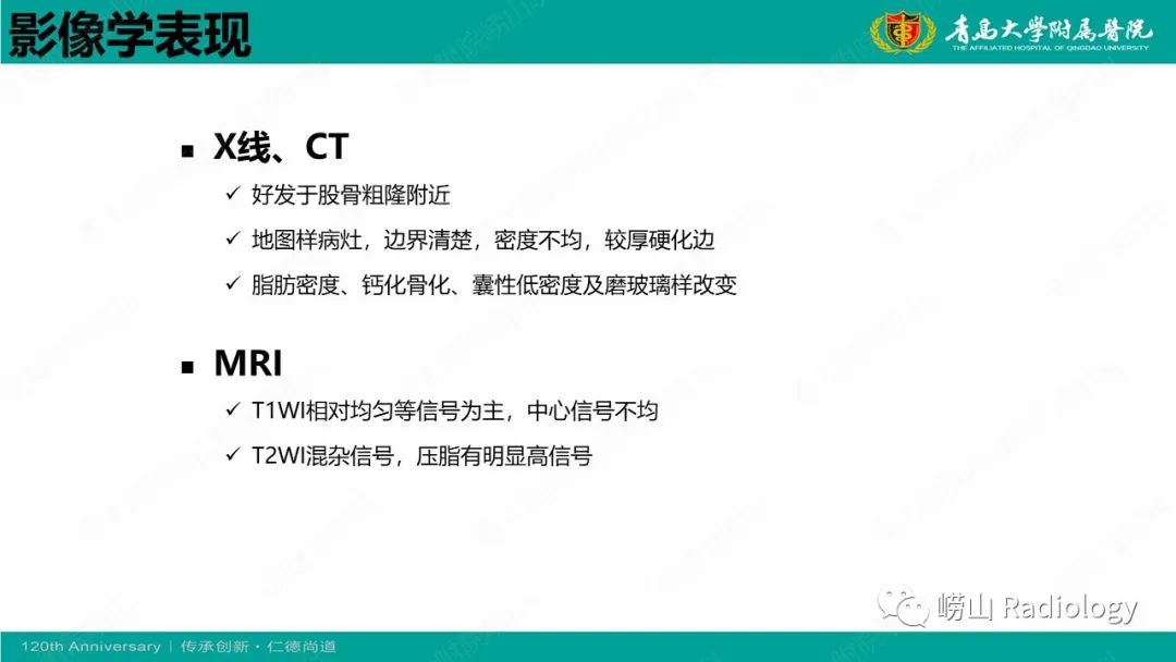 影像PPT - 【病例】脂肪硬化性黏液纤维性肿瘤1例X线CT及MR-14