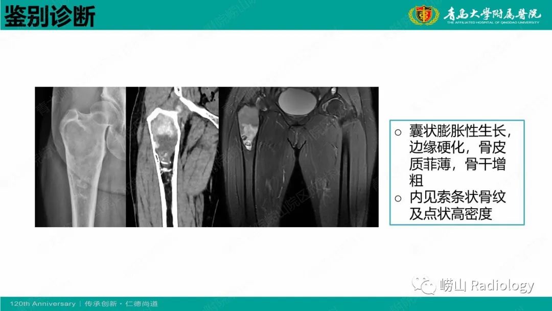 影像PPT - 【病例】脂肪硬化性黏液纤维性肿瘤1例X线CT及MR-19