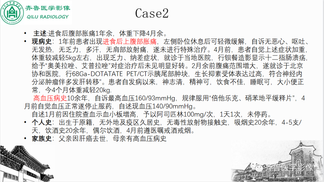 影像PPT - 【PPT】非功能性胰腺神经内分泌肿瘤-9
