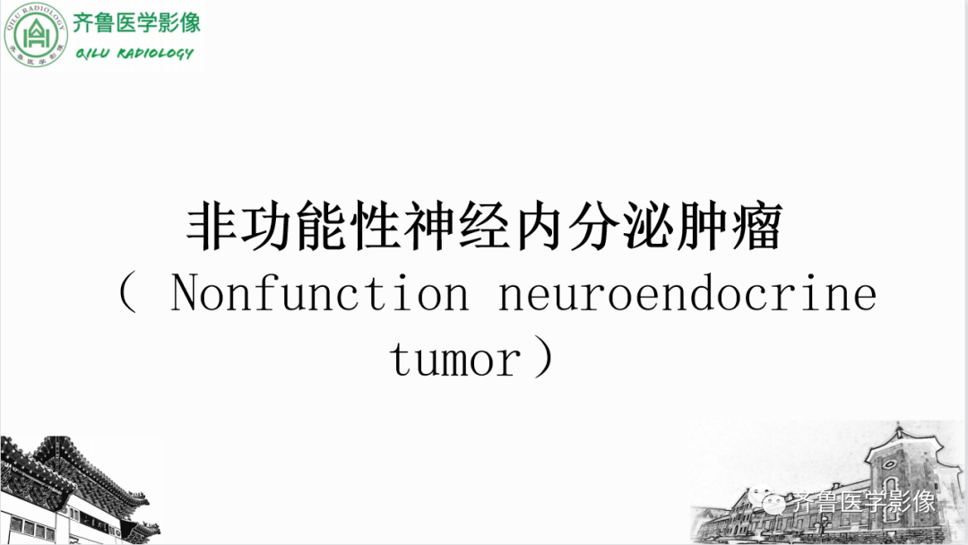 影像PPT - 【PPT】非功能性胰腺神经内分泌肿瘤-14