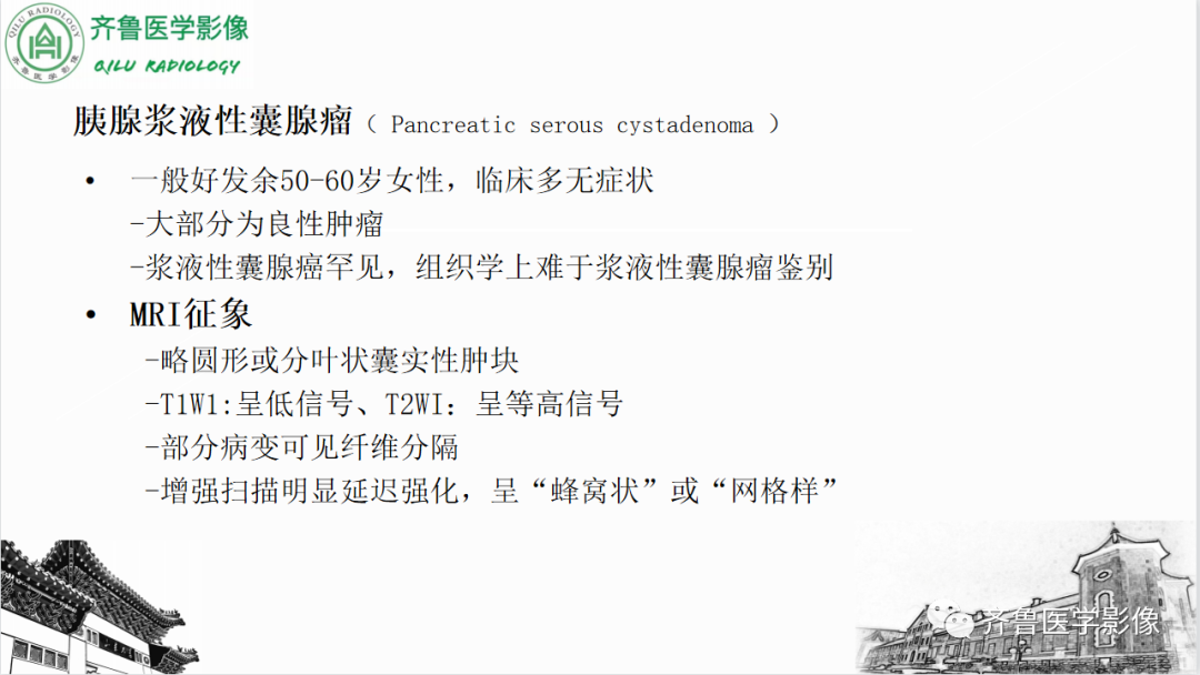 影像PPT - 【PPT】非功能性胰腺神经内分泌肿瘤-31