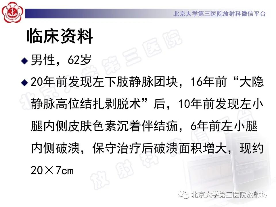 影像PPT - 【PPT】COCKETT综合征-2