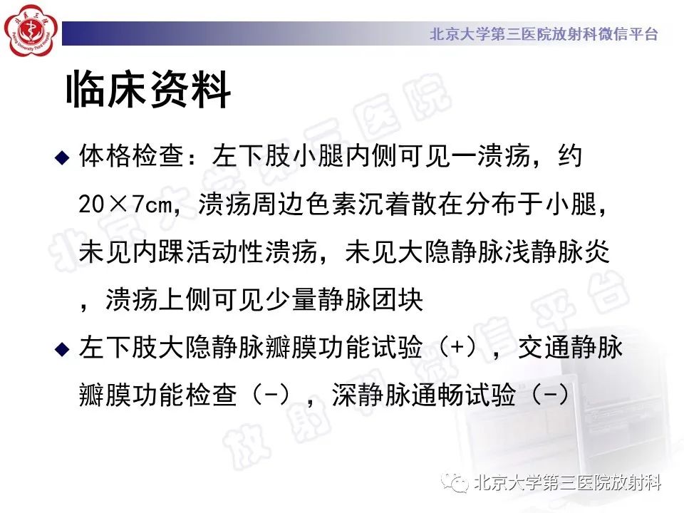 影像PPT - 【PPT】COCKETT综合征-3