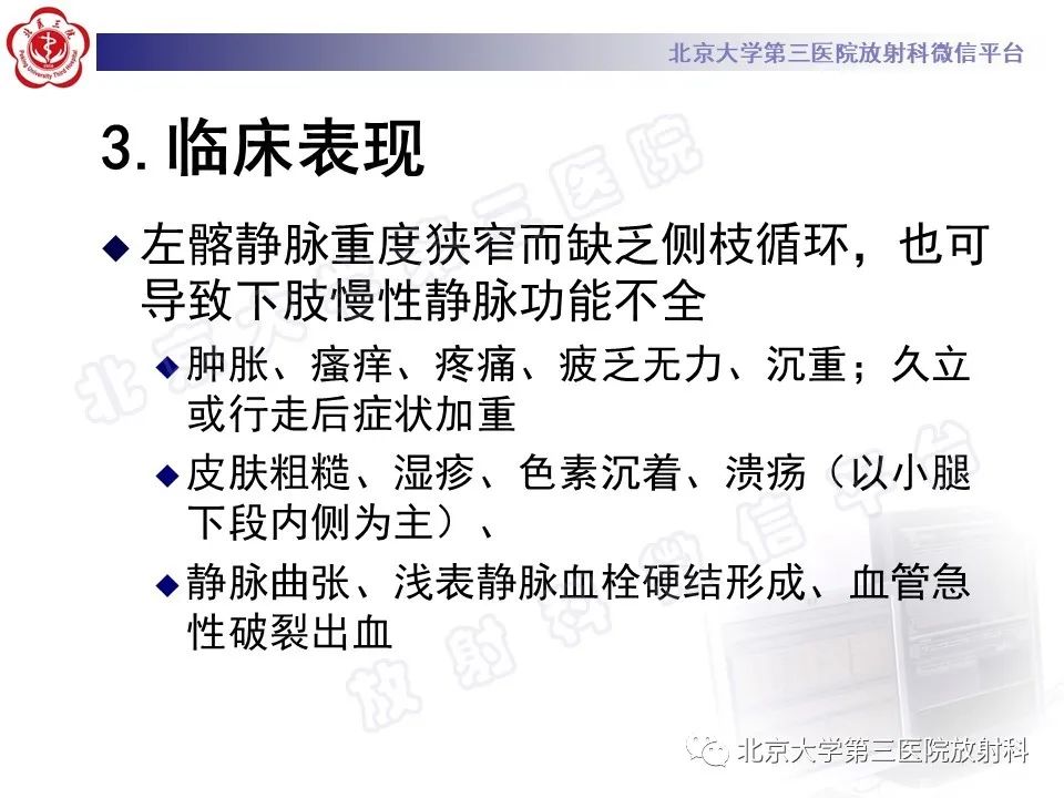 影像PPT - 【PPT】COCKETT综合征-16