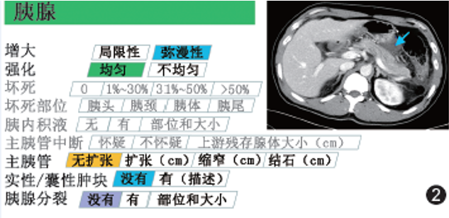 影像PPT - 急性胰腺炎国际结构化CT报告模板解读-3 影像PPT - 急性胰腺炎国际结构化CT报告模板解读-3