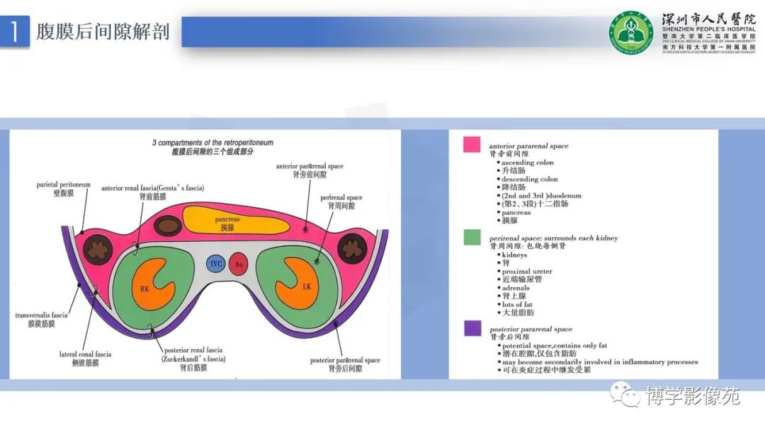 影像PPT - 【PPT】腹膜后间隙解剖及相关疾病-4