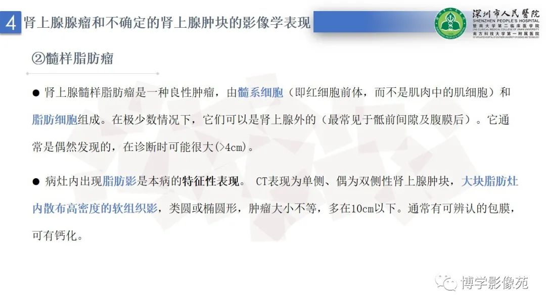 影像PPT - 【PPT】腹膜后间隙解剖及相关疾病-21