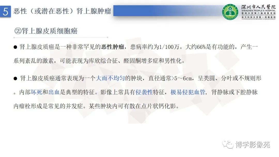 影像PPT - 【PPT】腹膜后间隙解剖及相关疾病-29
