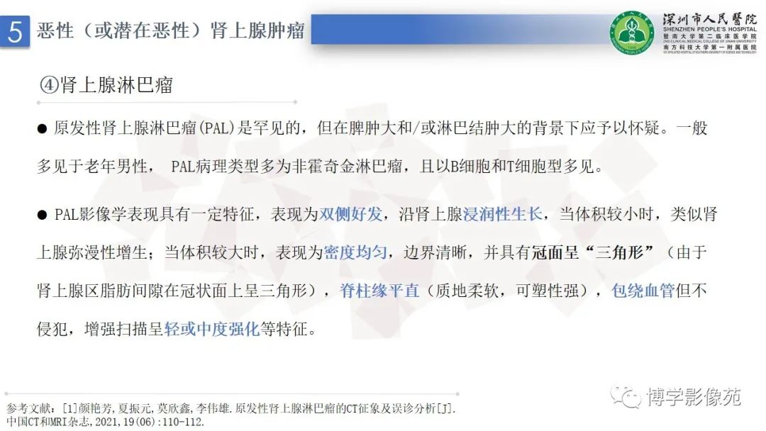 影像PPT - 【PPT】腹膜后间隙解剖及相关疾病-33