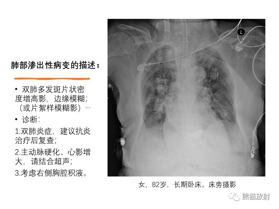 影像PPT - 【PPT】X线诊断报告的书写-9