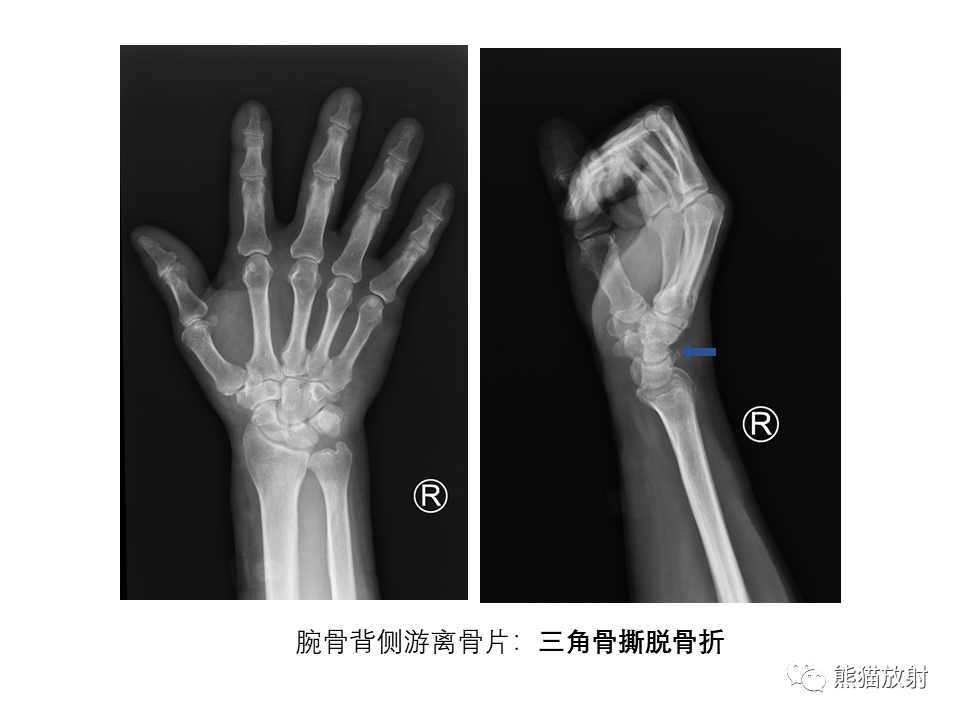 影像PPT - 【PPT】X线诊断报告的书写-12