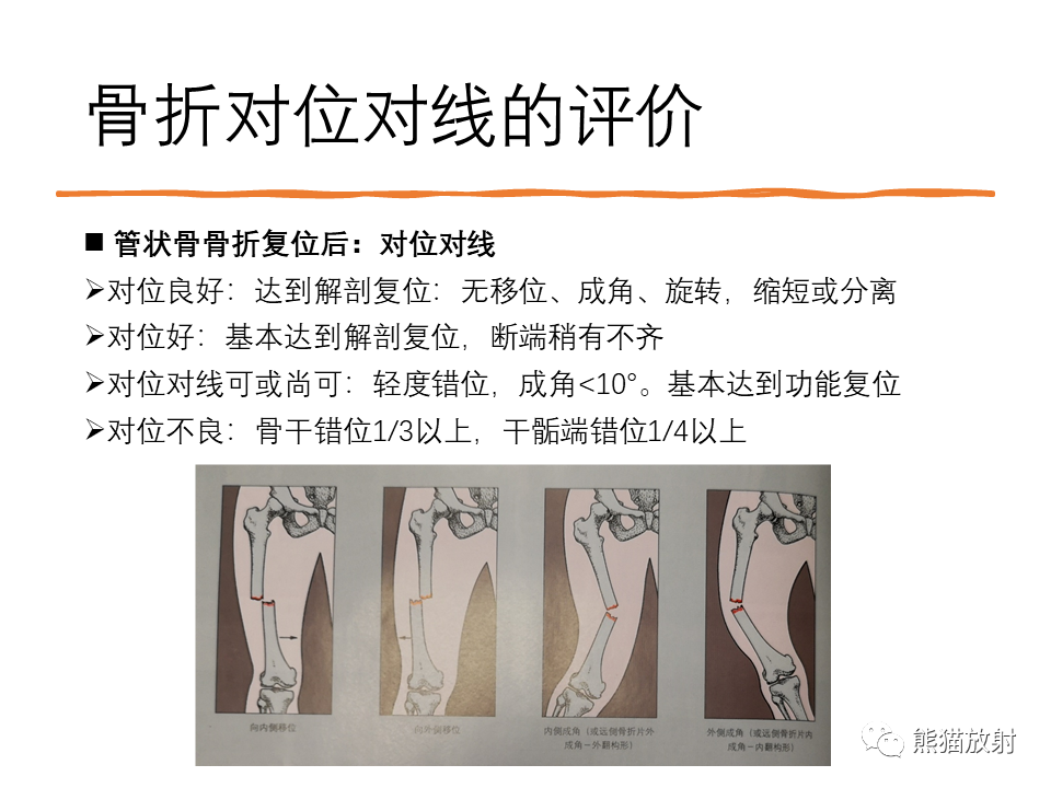 影像PPT - 【PPT】X线诊断报告的书写-13