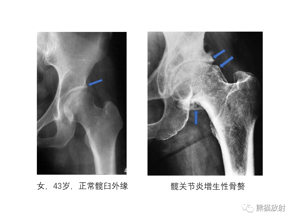 影像PPT - 【PPT】X线诊断报告的书写-15