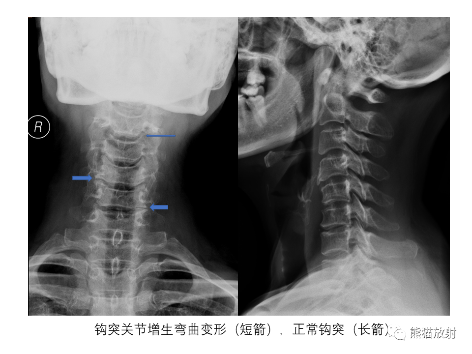 影像PPT - 【PPT】X线诊断报告的书写-16