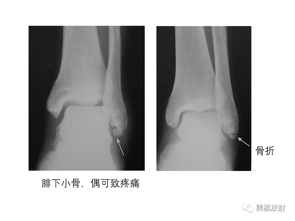 影像PPT - 【PPT】X线诊断报告的书写-17