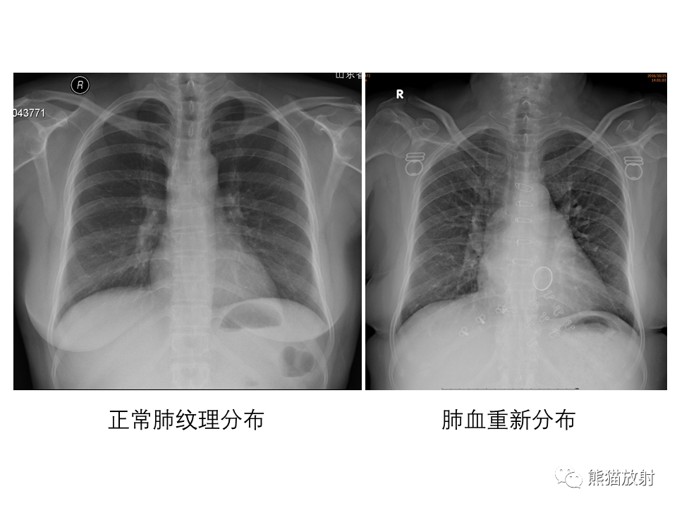 影像PPT - 【PPT】X线诊断报告的书写-20