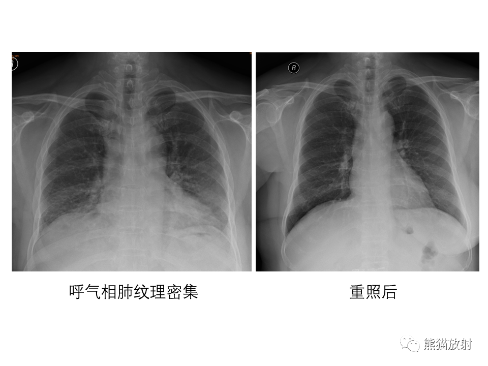 影像PPT - 【PPT】X线诊断报告的书写-21