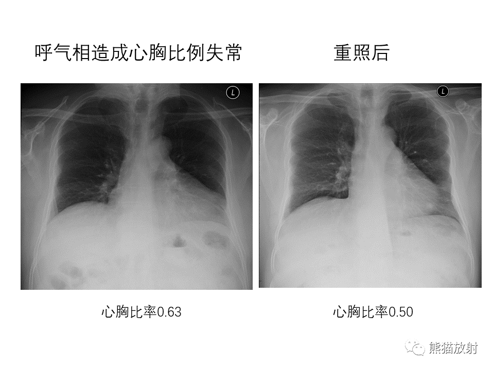 影像PPT - 【PPT】X线诊断报告的书写-22