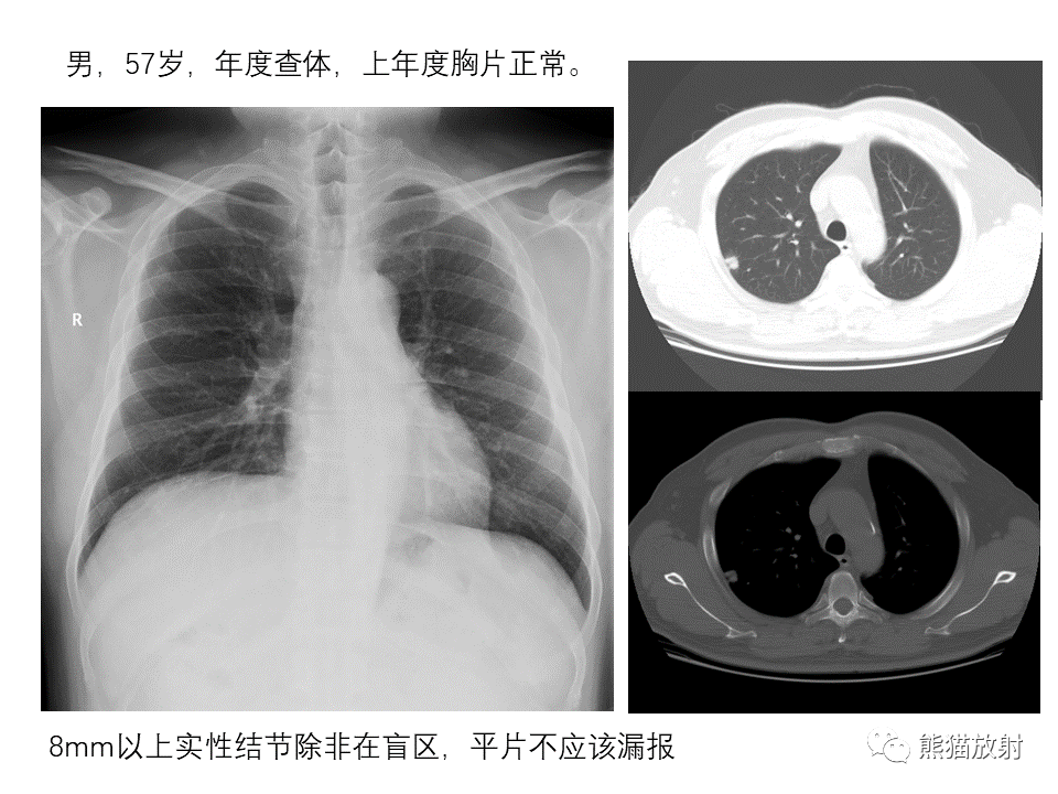 影像PPT - 【PPT】X线诊断报告的书写-25