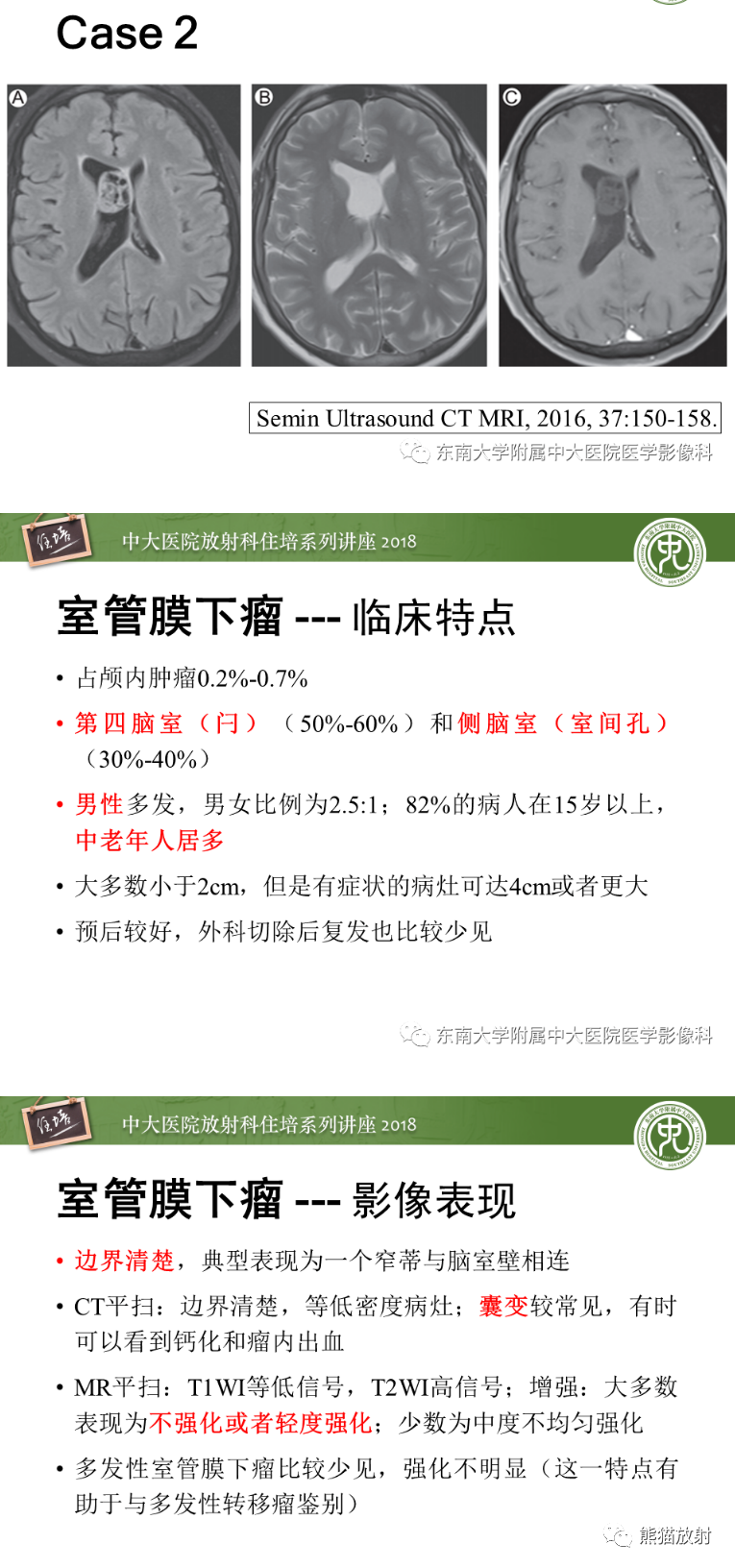 影像PPT - 【病例】侧脑室室管膜瘤1例MR影像表现-10