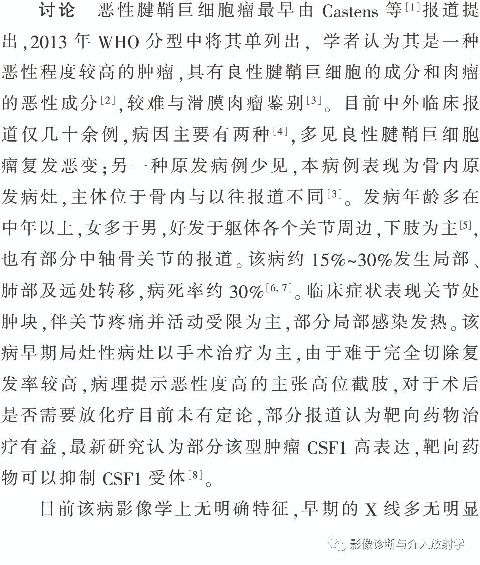 影像PPT - 【病例】胫骨骨内原发恶性腱鞘巨细胞瘤一例X线MR-3 影像PPT - 【病例】胫骨骨内原发恶性腱鞘巨细胞瘤一例X线MR-3