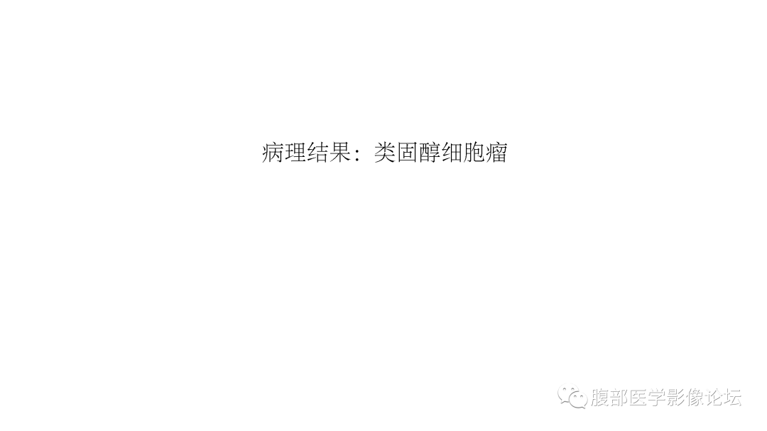 影像PPT - 【病例】卵巢类固醇细胞瘤1例MR影像-11 影像PPT - 【病例】卵巢类固醇细胞瘤1例MR影像-11