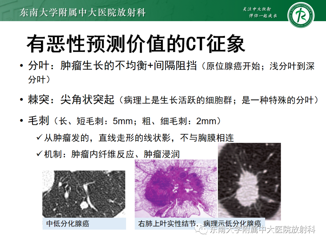影像PPT - 【PPT】基于病理基础的肺腺癌影像学表现-9