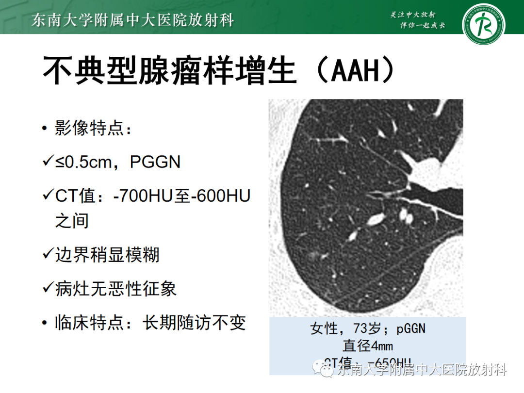 影像PPT - 【PPT】基于病理基础的肺腺癌影像学表现-22
