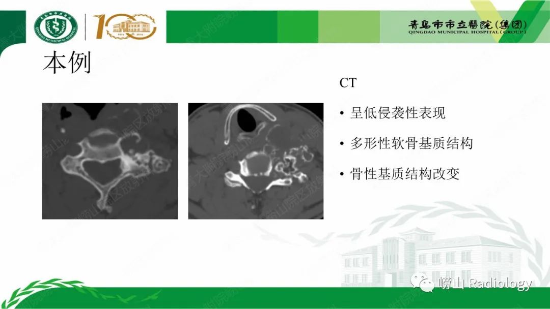 影像PPT - 【病例】继发型软骨肉瘤1例CT及MR影像-13