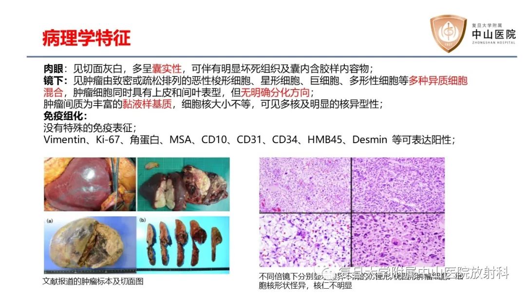 影像PPT - 【病例】肝脏未分化胚胎性肉瘤2例MR影像-10