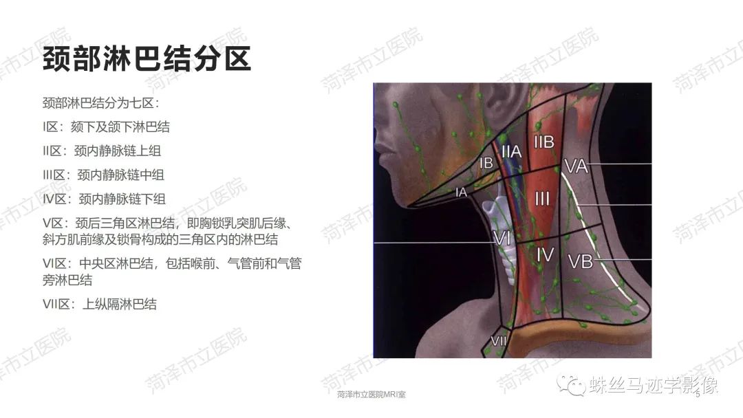 影像PPT - 【PPT】颈部间隙CT和MRI诊断-5