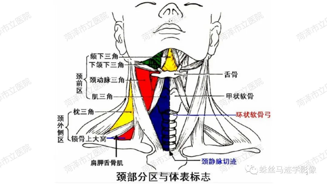 影像PPT - 【PPT】颈部间隙CT和MRI诊断-2
