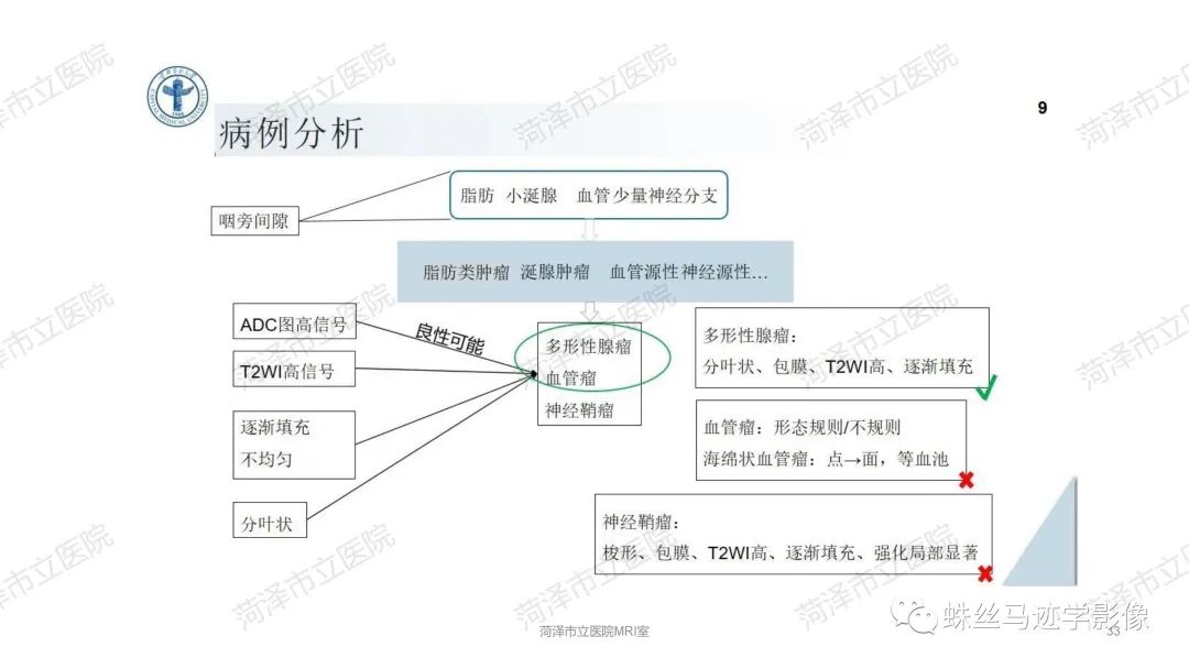 影像PPT - 【PPT】颈部间隙CT和MRI诊断-33