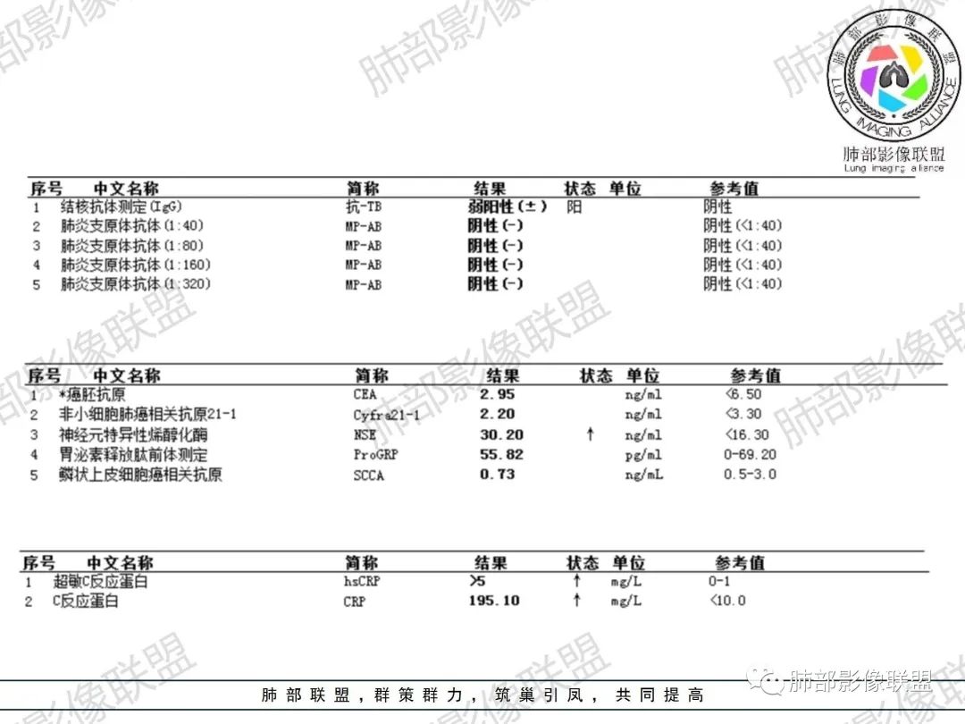 影像PPT - 【病例】诡异的肺部感染—诺卡菌-6 影像PPT - 【病例】诡异的肺部感染—诺卡菌-6