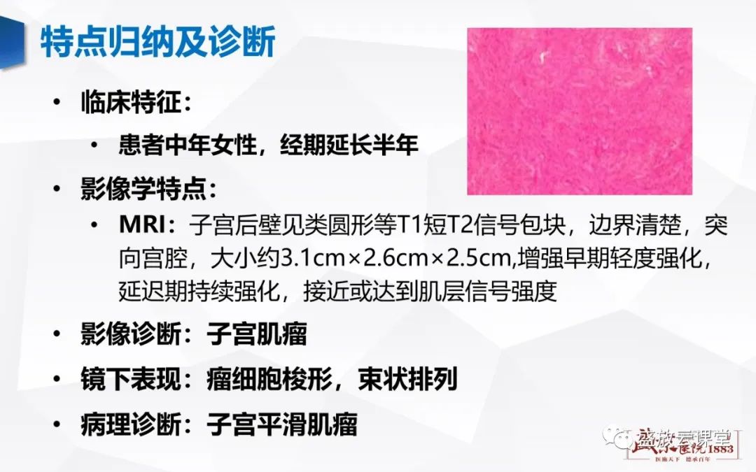 影像PPT - 【病例】特殊类型子宫平滑肌瘤3例MR影像鉴别-7