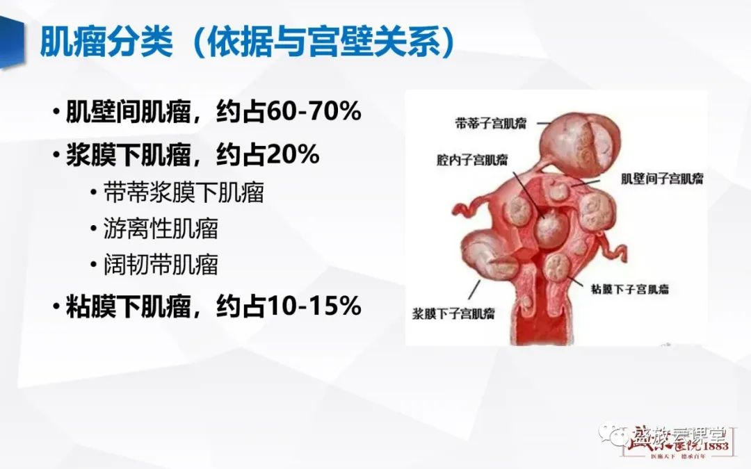 影像PPT - 【病例】特殊类型子宫平滑肌瘤3例MR影像鉴别-15