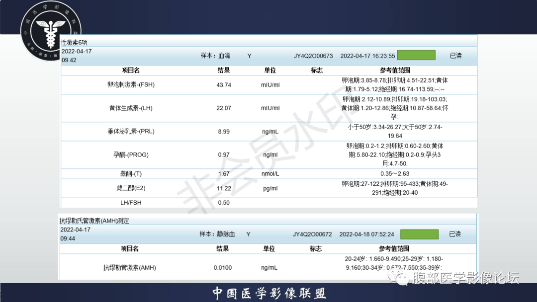 影像PPT - 【病例】盆腔腹膜后去分化脂肪肉瘤1例MR-5