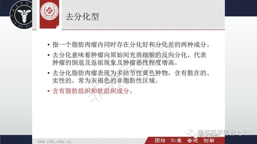 影像PPT - 【病例】盆腔腹膜后去分化脂肪肉瘤1例MR-53