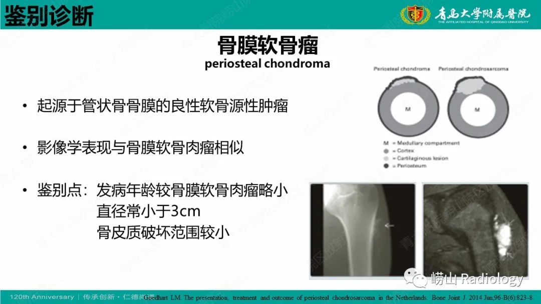 影像PPT - 【病例】胫骨骨膜软骨肉瘤1例CT及MR-20