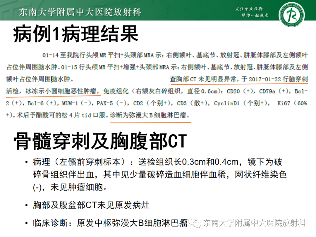 影像PPT - 【PPT】原发性中枢神经系统淋巴瘤的影像学表现-3