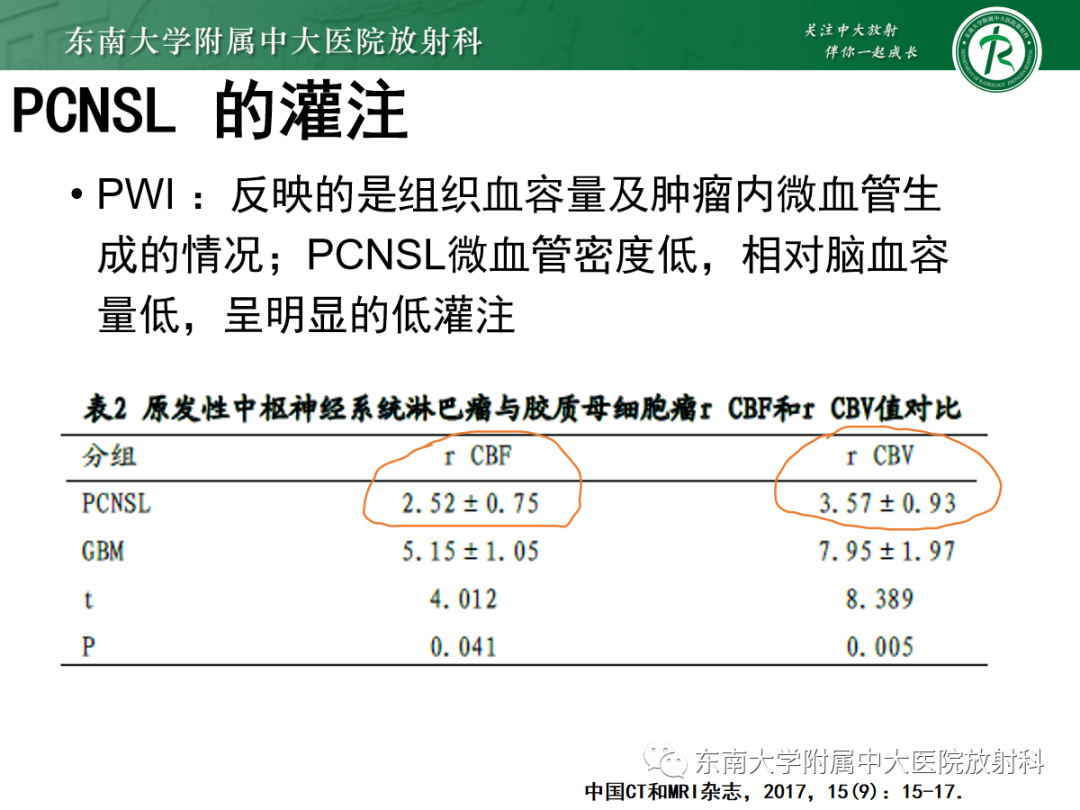 影像PPT - 【PPT】原发性中枢神经系统淋巴瘤的影像学表现-16