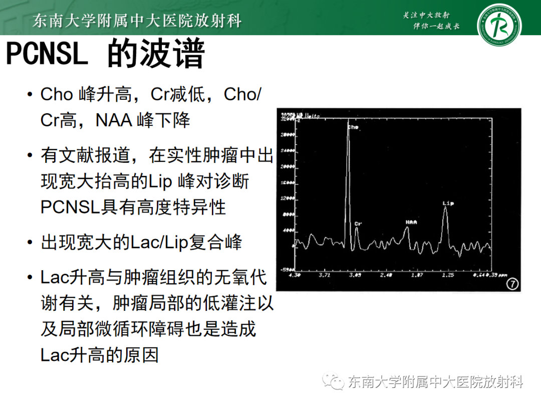 影像PPT - 【PPT】原发性中枢神经系统淋巴瘤的影像学表现-18