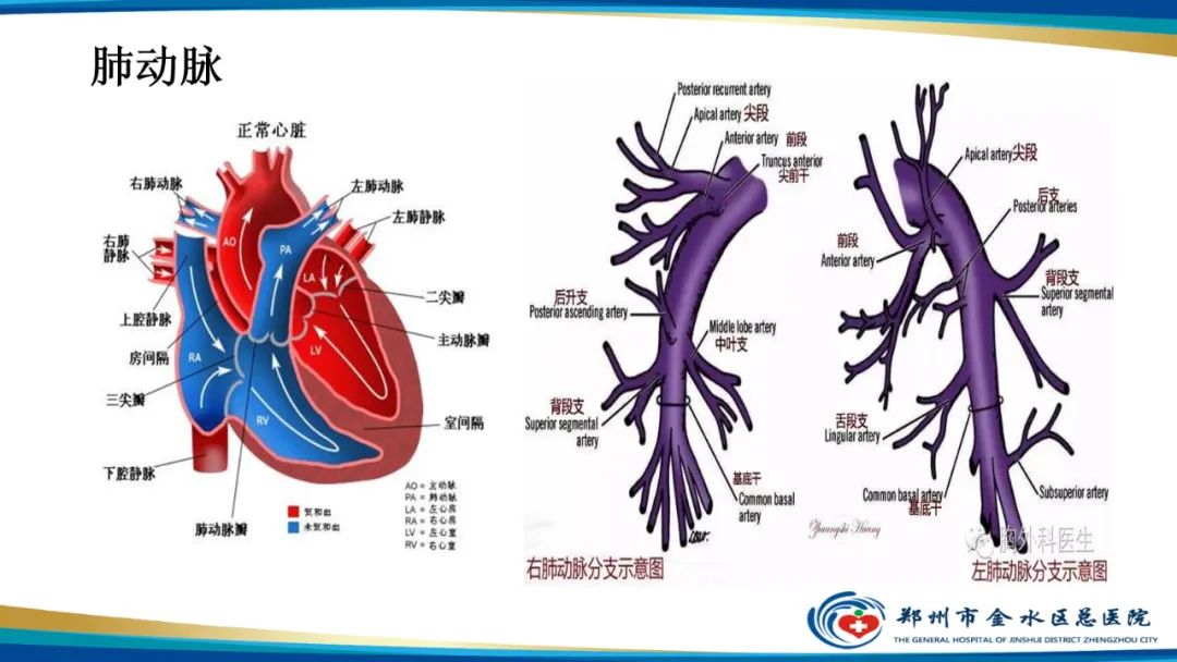 影像PPT - 【PPT】肺动脉CTA扫描技术-6