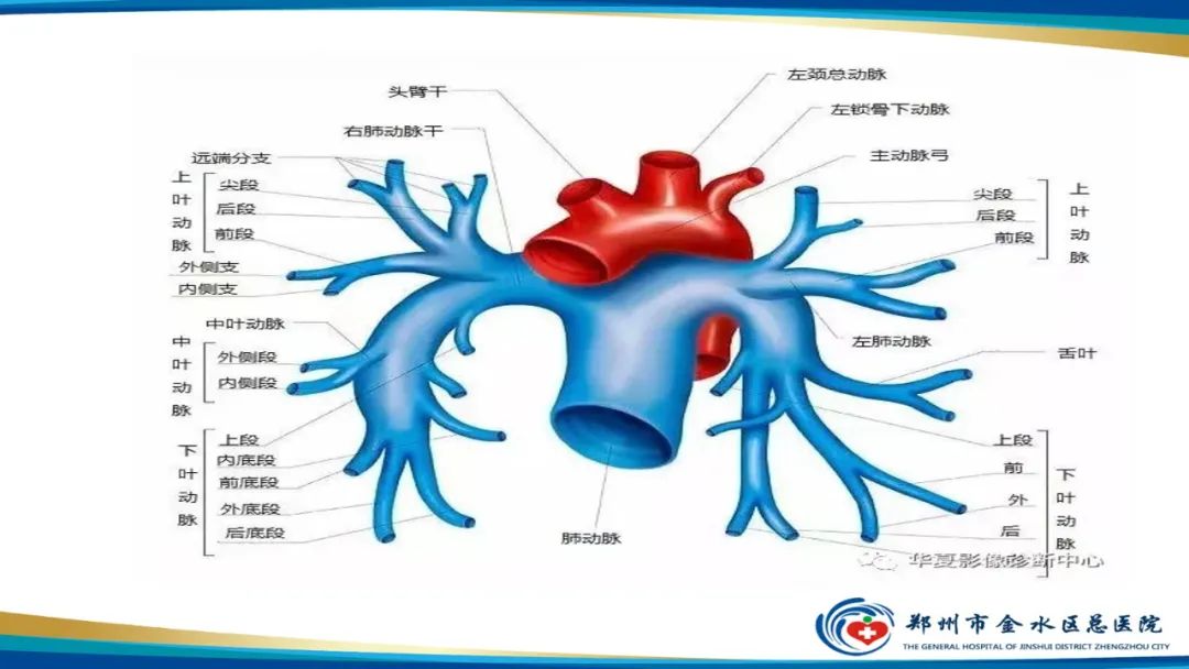 影像PPT - 【PPT】肺动脉CTA扫描技术-7
