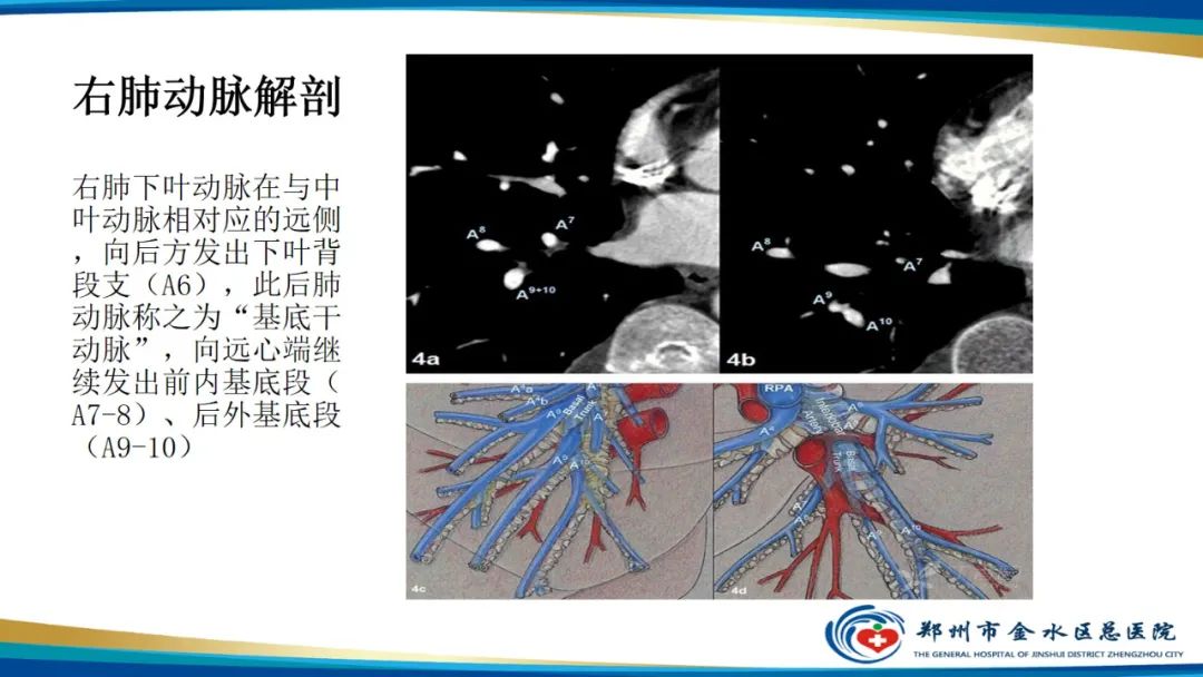 影像PPT - 【PPT】肺动脉CTA扫描技术-10