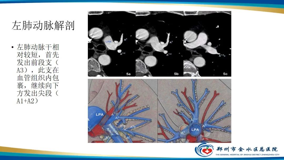 影像PPT - 【PPT】肺动脉CTA扫描技术-11