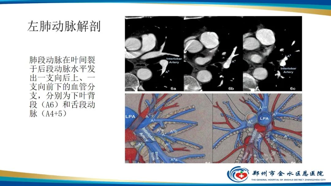 影像PPT - 【PPT】肺动脉CTA扫描技术-12