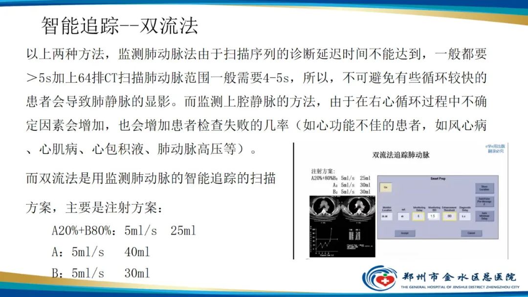 影像PPT - 【PPT】肺动脉CTA扫描技术-29