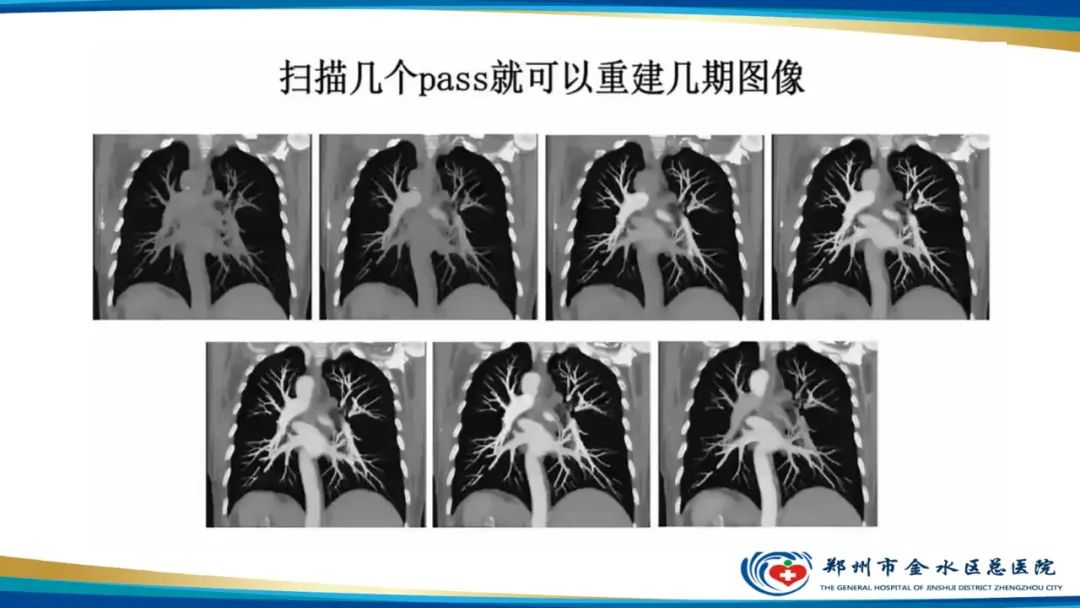 影像PPT - 【PPT】肺动脉CTA扫描技术-38