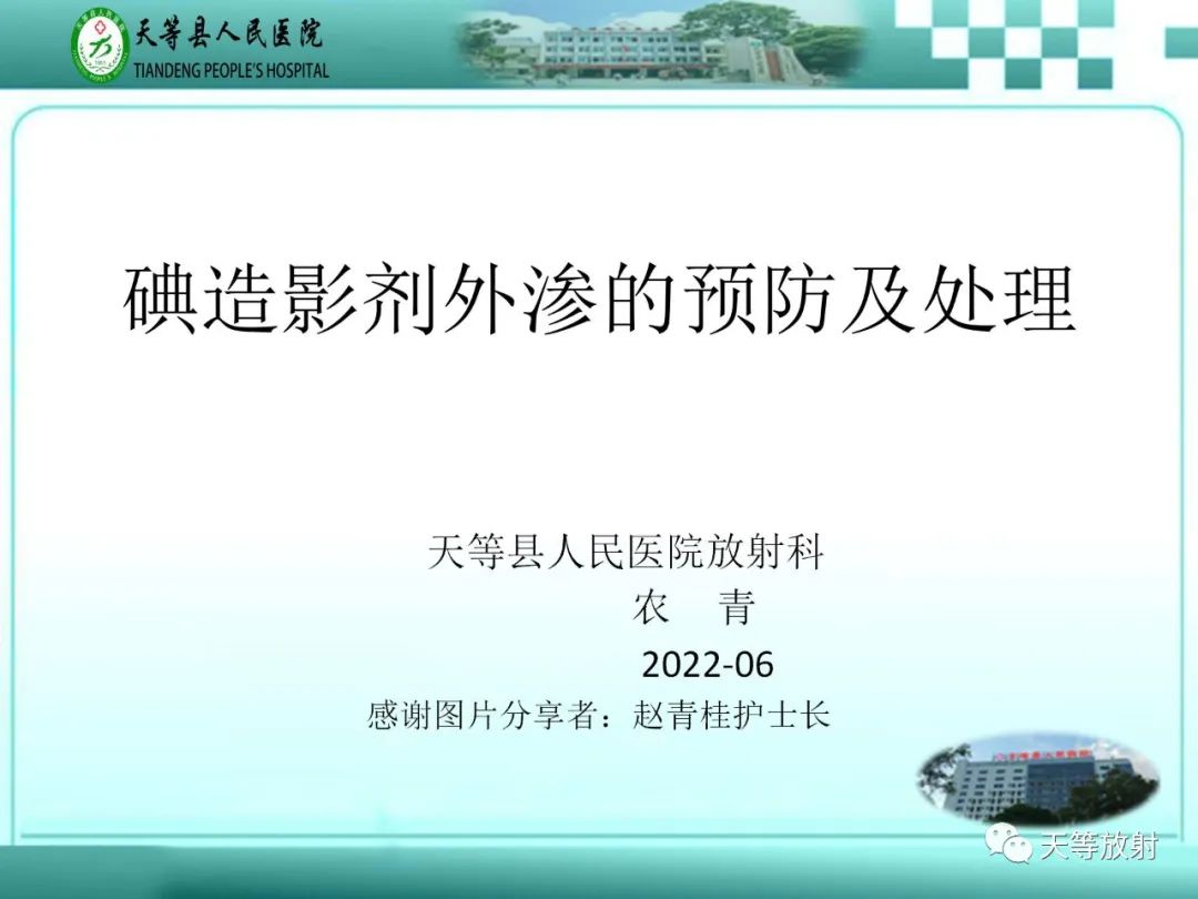 影像PPT - 【PPT】碘造影剂外渗的预防及处理-1